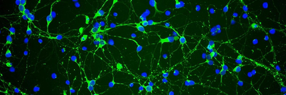 Aleksandra Netronina